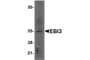 Image no. 2 for anti-Interleukin-27 subunit beta (IL-27b) (Internal Region) antibody (ABIN341721) (EBI3 anticorps  (Internal Region))