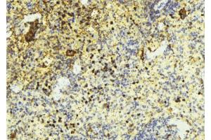 ABIN6269379 at 1/100 staining Mouse liver tissue by IHC-P.