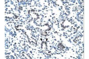 Image no. 1 for anti-EVX1 (EVX1) (AA 74-123) antibody (ABIN202451) (EVX1 anticorps  (AA 74-123))