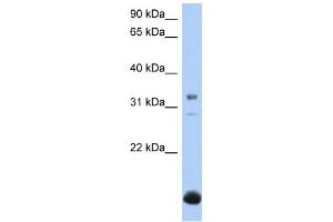 Western Blotting (WB) image for anti-UDP-Gal:betaGal beta 1,3-Galactosyltransferase Polypeptide 6 (B3GALT6) antibody (ABIN2459385) (B3GALT6 anticorps)