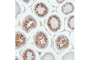 IHC analysis of CDK1 using anti-CDK1 antibody (ABIN7602240). (CDK1 anticorps  (AA 66-297))