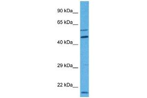 Host:  Rabbit  Target Name:  MBOAT1  Sample Tissue:  Human 786-0 Whole Cell  Antibody Dilution:  1ug/ml (MBOAT1 anticorps  (N-Term))