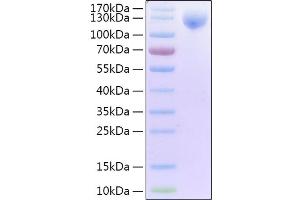 Recombinant 2019-nCoV Spike S1 Protein with His and Avi tag on Tris-Bis PAGE under reduced condition.