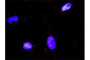 Proximity Ligation Analysis of protein-protein interactions between PARD3 and CTNNB1.