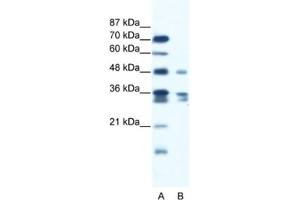 Western Blotting (WB) image for anti-Zinc Finger Protein 577 (ZNF577) antibody (ABIN2461281) (ZNF577 anticorps)
