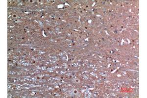 Immunohistochemistry (IHC) analysis of paraffin-embedded Rat Brain, antibody was diluted at 1:100.