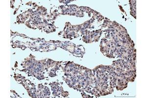 IHC analysis of Neurofibromin/NF1 using anti-Neurofibromin/NF1 antibody (ABIN7600196).