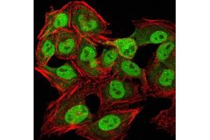 Immunofluorescence analysis of Hela cells using CBX1 mouse mAb (green).