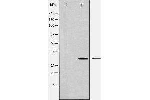 Western blot analysis of HEX293  lysate using CDCA8 antibody. (CDCA8 anticorps)