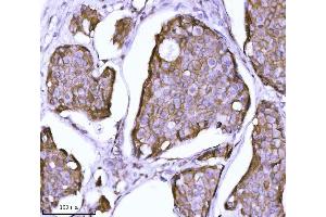 IHC analysis of CTNND1 using anti-CTNND1 antibody (ABIN7602220). (CTNND1 anticorps  (AA 64-930))
