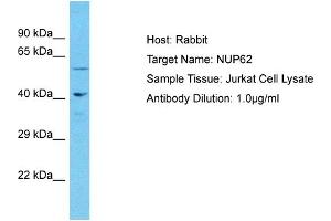 Host: Rabbit Target Name: NUP62 Sample Type: Jurkat Whole Cell lysates Antibody Dilution: 1. (NUP62 anticorps  (Middle Region))