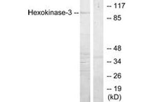 Western blot analysis of extracts from Jurkat cells, treated with insulin 0. (HK3 anticorps  (AA 811-860))