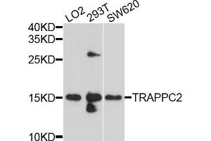 Western blot analysis of extracts of various cell lines, using TRAPPC2 antibody (ABIN5999090) at 1/1000 dilution. (TRAPPC2 anticorps)