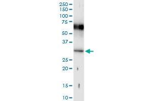 Immunoprecipitation of HOXB1 transfected lysate using anti-HOXB1 MaxPab rabbit polyclonal antibody and Protein A Magnetic Bead , and immunoblotted with HOXB1 MaxPab mouse polyclonal antibody (B01) .