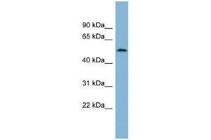 C2ORF29 antibody used at 1 ug/ml to detect target protein. (CNOT11 anticorps  (N-Term))