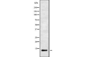 Western blot analysis IFI6 using HeLa whole cell lysates (IFI6 anticorps)