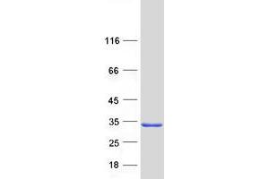 Validation with Western Blot