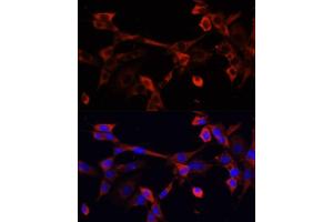 Immunofluorescence analysis of NIH/3T3 cells using DNL1 antibody (ABIN6130967, ABIN6139736, ABIN6139738 and ABIN6217037) at dilution of 1:100. (DNASEX anticorps  (AA 1-302))