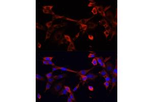Immunofluorescence analysis of NIH/3T3 cells using DNL1 antibody (ABIN6130967, ABIN6139736, ABIN6139738 and ABIN6217037) at dilution of 1:100.