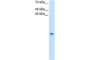 RBP1 antibody used at 2.