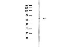 anti-TROVE Domain Family, Member 2 (TROVE2) (N-Term) antibody