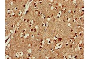 Immunohistochemistry of paraffin-embedded human brain tissue using ABIN7147395 at dilution of 1:100 (C3orf34 anticorps  (AA 1-163))