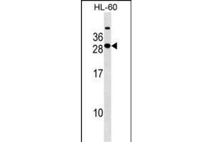 STXBP6 Antibody (Center) (ABIN1538584 and ABIN2849443) western blot analysis in HL-60 cell line lysates (35 μg/lane). (STXBP6 anticorps  (AA 71-97))