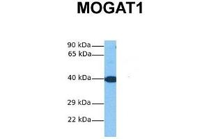 Host:  Rabbit  Target Name:  MOGAT1  Sample Tissue:  Human Fetal Liver  Antibody Dilution:  1. (MOGAT1 anticorps  (C-Term))