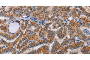 Immunohistochemistry of paraffin-embedded Human brain tissue using ALG9 Polyclonal Antibody at dilution 1:60 (ALG9 anticorps)