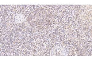 Detection of MMP7 in Human Spleen Tissue using Monoclonal Antibody to Matrix Metalloproteinase 7 (MMP7) (MMP7 anticorps  (AA 18-267))