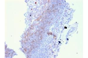 Formalin-fixed, paraffin-embedded human Lymph Node in Colon stained with CD72 Mouse Monoclonal Antibody (BU40). (CD72 anticorps)