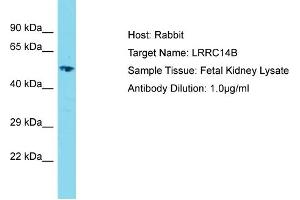 Host: Rabbit Target Name: LRRC14B Sample Type: Fetal Kidney lysates Antibody Dilution: 1. (LRRC14B anticorps  (C-Term))