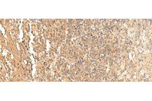 Immunohistochemistry of paraffin-embedded Human tonsil tissue using GTF3A Polyclonal Antibody at dilution of 1:60(x200)