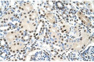 Human kidney; AKAP8L antibody - C-terminal region in Human kidney cells using Immunohistochemistry (AKAP8L anticorps  (C-Term))