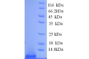 SDS-PAGE (SDS) image for Glucosidase, Beta, Acid (GBA) (AA 53-89) protein (His tag) (ABIN5713466)