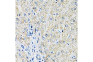 Immunohistochemistry of paraffin-embedded human liver using SLC19A1 antibody (ABIN6291462) at dilution of 1:100 (40x lens).