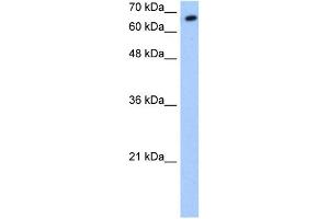 WB Suggested Anti-SYVN1 Antibody Titration:  0. (SYVN1 anticorps  (C-Term))