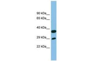 Image no. 1 for anti-Receptor (Chemosensory) Transporter Protein 4 (RTP4) (AA 107-156) antibody (ABIN6745178) (RTP4 anticorps  (AA 107-156))