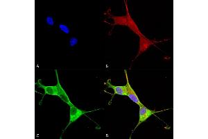 Immunocytochemistry/Immunofluorescence analysis using Mouse Anti-Copper Transporting ATPase 1 Monoclonal Antibody, Clone S60-4 (ABIN2485192).