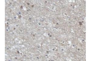 Detection of PCDHa1 in Human Cerebrum Tissue using Polyclonal Antibody to Protocadherin Alpha 1 (PCDHa1)