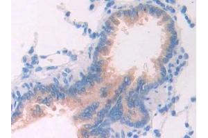 Detection of IL1R1 in Rat Lung Tissue using Polyclonal Antibody to Interleukin 1 Receptor Type I (IL1R1)