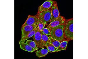 Immunofluorescence analysis of Hela cells using ALDOA mouse mAb (green). (ALDOA anticorps  (AA 9-145))