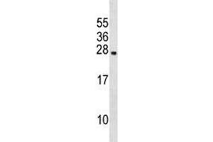 Prolactin antibody western blot analysis in 293 lysate.
