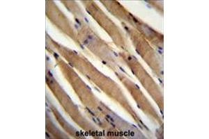 anti-Ubiquitin Specific Peptidase 50 (USP50) (AA 148-178), (Middle Region) antibody