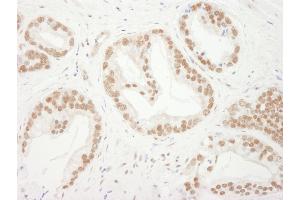 Immunohistochemistry (IHC) image for anti-Budding Uninhibited By Benzimidazoles 3 Homolog (Yeast) (BUB3) (AA 275-325) antibody (ABIN7449397)