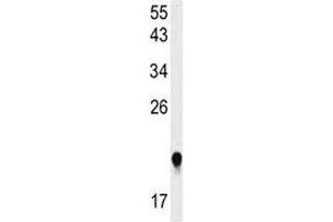 Western blot analysis of IMP3 antibody and HeLa lysate. (IMP3 anticorps  (AA 156-184))