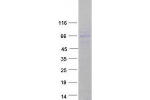Validation with Western Blot