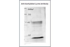 Image no. 2 for anti-Acetylated Lysine (acetylated) antibody (ABIN264880) (Acetylated Lysine anticorps  (acetylated))
