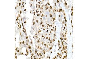 Immunohistochemistry of paraffin-embedded rat lung using XRCC2 Rabbit pAb  at dilution of 1:50 (40x lens). (XRCC2 anticorps)