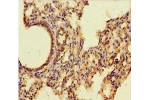 Immunohistochemistry of paraffin-embedded human lung tissue using ABIN7143728 at dilution of 1:100